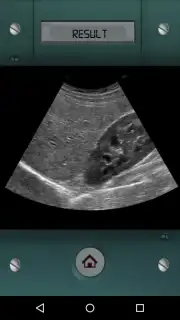 Scanner X-ray скриншот 3