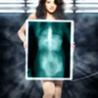 веселые рентгеновские лучи
